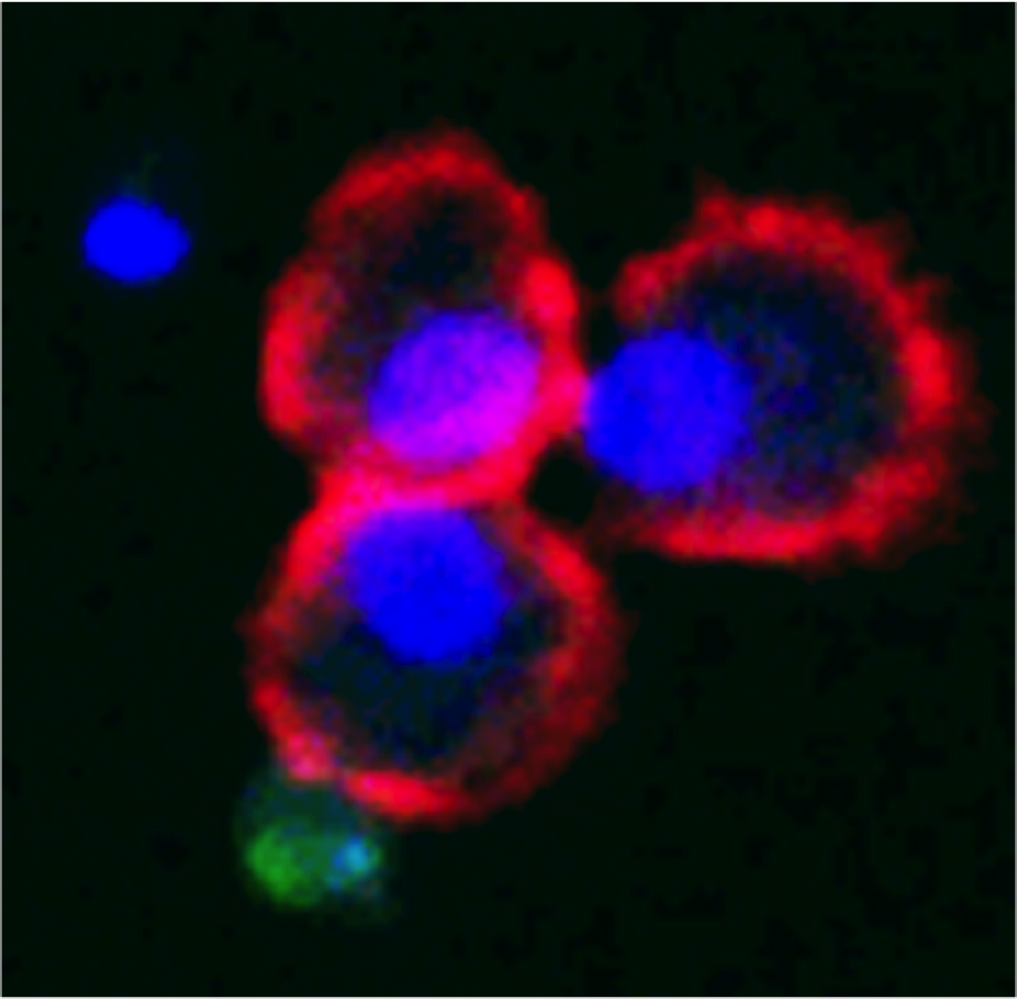 In this microscopic image, three cells of the innate immune response are seen next to two T-cells. T-cells appear blue when they’re not active. Only when they make contact with and are activated by the innate cells do the T-cells turn on Protein S, causi In this microscopic image, three cells of the innate immune response are seen next to two T-cells. T-cells appear blue when they’re not active. Only when they make contact with and are activated by the innate cells do the T-cells turn on Protein S, causi